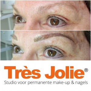 Voor en na (Medium)