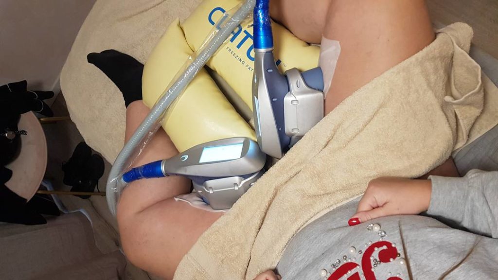 Cryolipolyse behandeling bij Blush Clinic Groningen