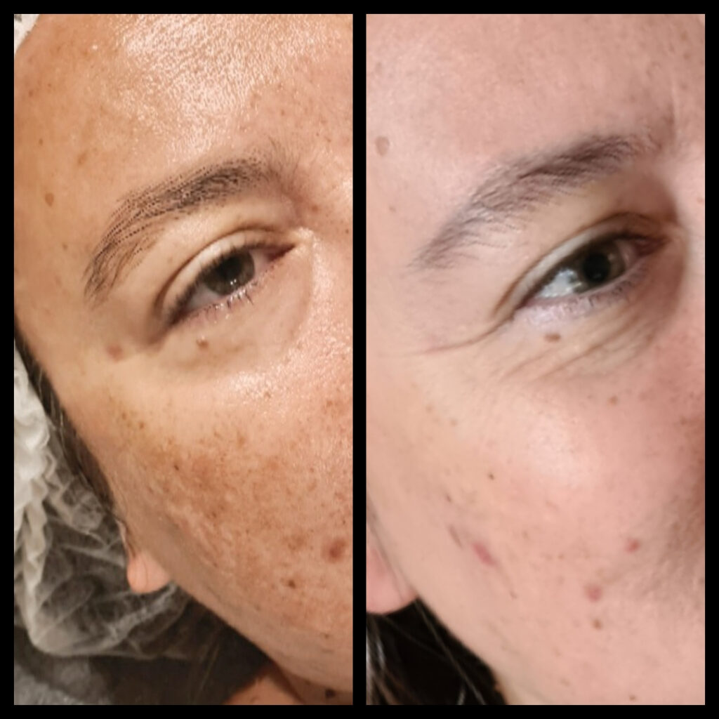 Zeg vaarwel tegen pigmentvlekken met de nieuwe CELLULAR LUMINOUS630® Anti- Spot producten