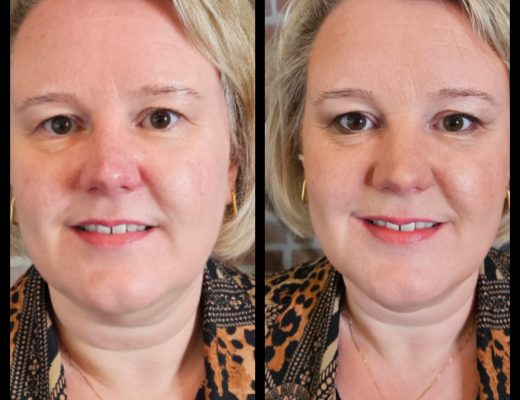 Rosacea en minerale make-up: een perfecte match en een Demo