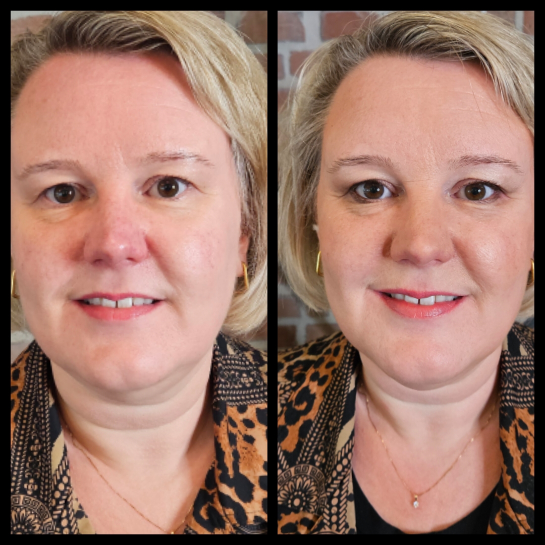Rosacea en minerale make-up: een perfecte match en een Demo